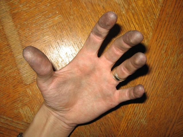 Showing Kabutroid's heavily dust-covered fingers, from working with the rings.