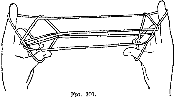 Fig. 301
