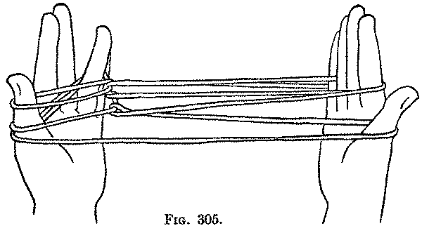 Fig. 305