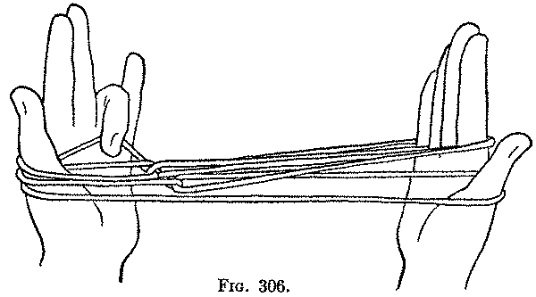 Fig. 306