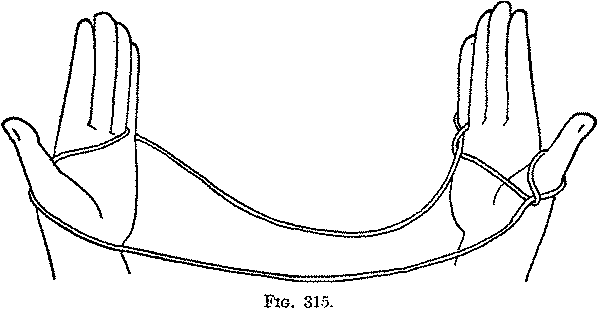 Fig. 315