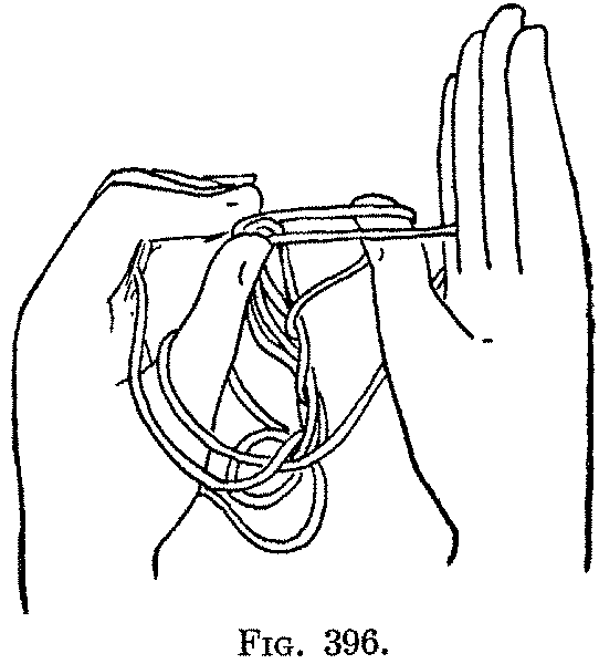 Fig. 396