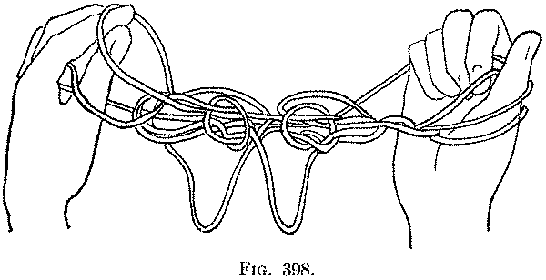 Fig. 398