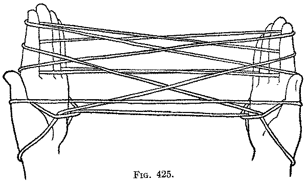 Fig. 425