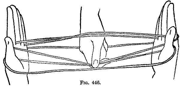 Fig. 446