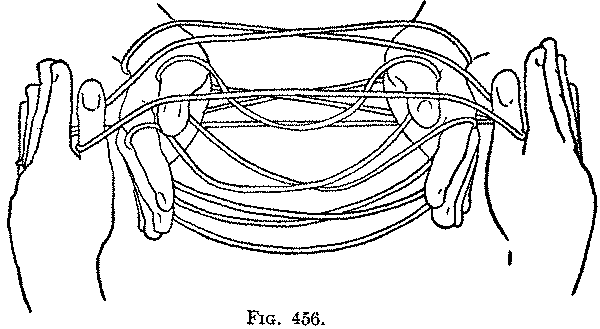 Fig. 456