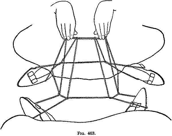 Fig. 463
