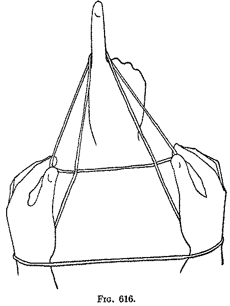 Fig. 616