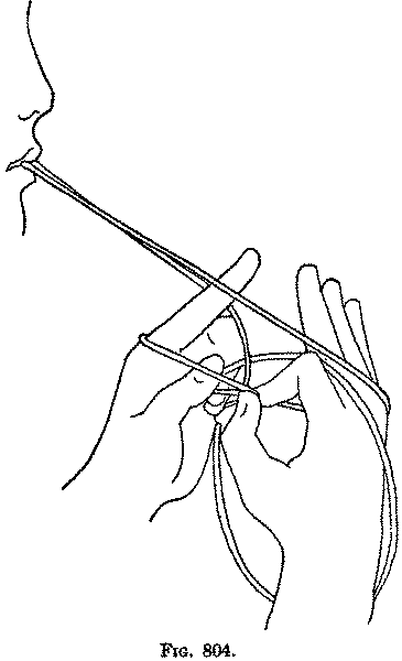 Fig. 804